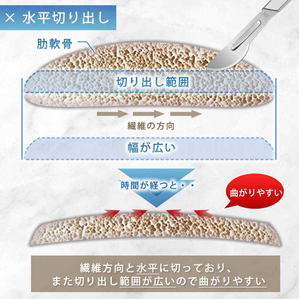 肋軟骨の水平切り出しの図解
