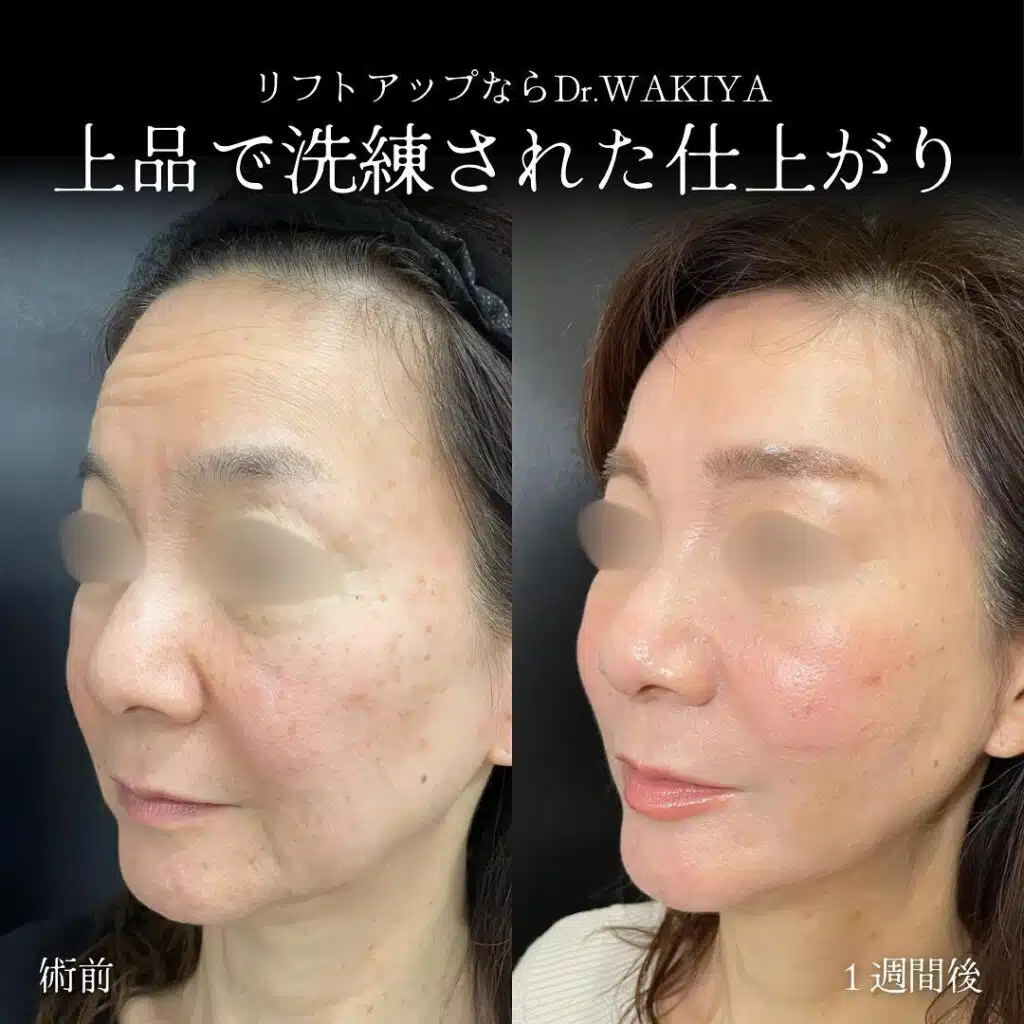 上品で洗練された仕上がり 京都