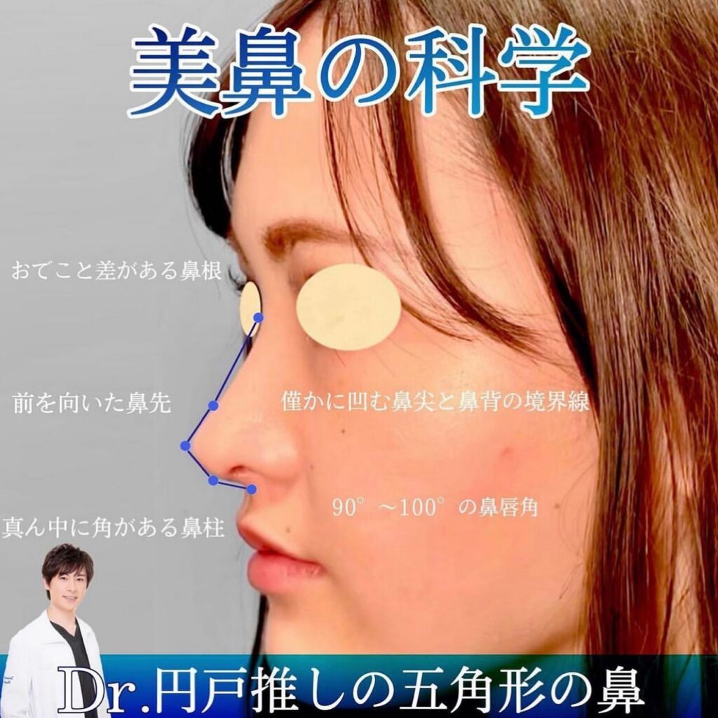 鼻中隔延長と軟骨移植と小鼻縮小と鼻尖形成症例写真 (2)