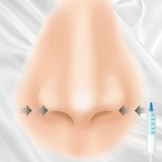 小鼻縮小ボトックスのアイコン