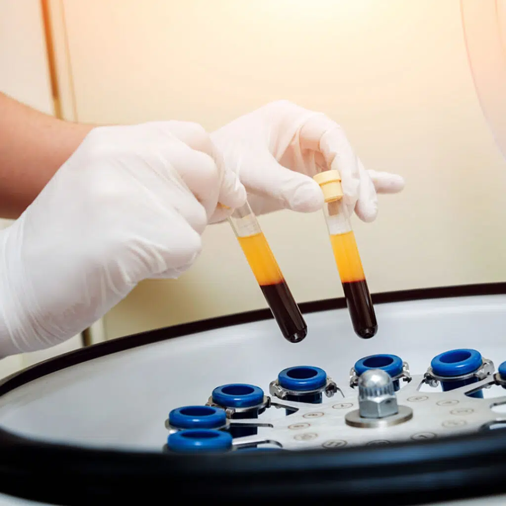 PRP再生医療のイメージ