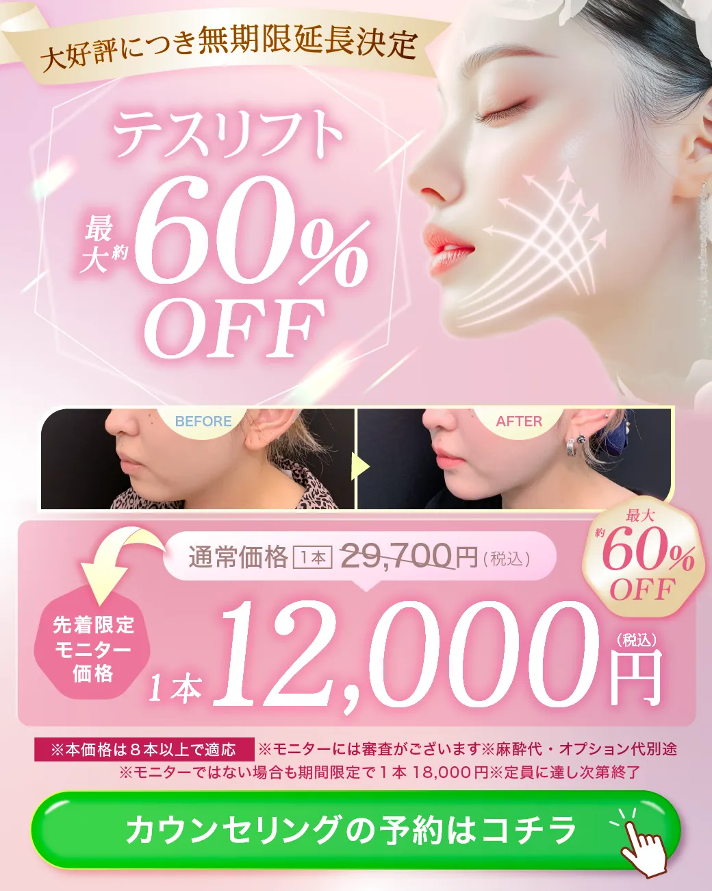 閑散期テスリフトのキャンペーンバナー