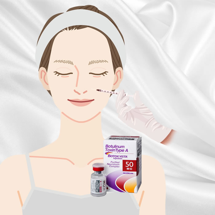 法令線のボトックスのイメージ