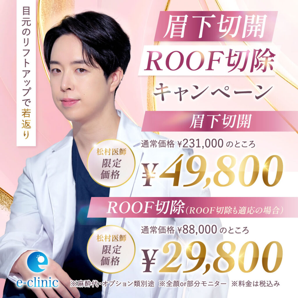松村 健太医師の眉下切開のキャンペーンバナー