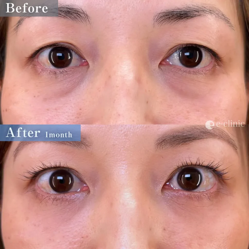 クマ取り_裏ハムラ（島田良浩）（2）