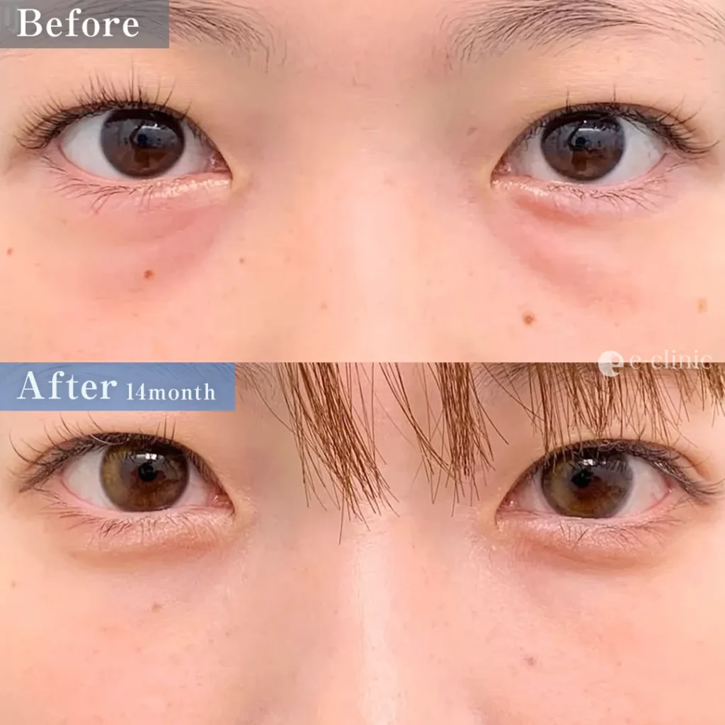 クマ取り_裏ハムラ（張田修平）（17）