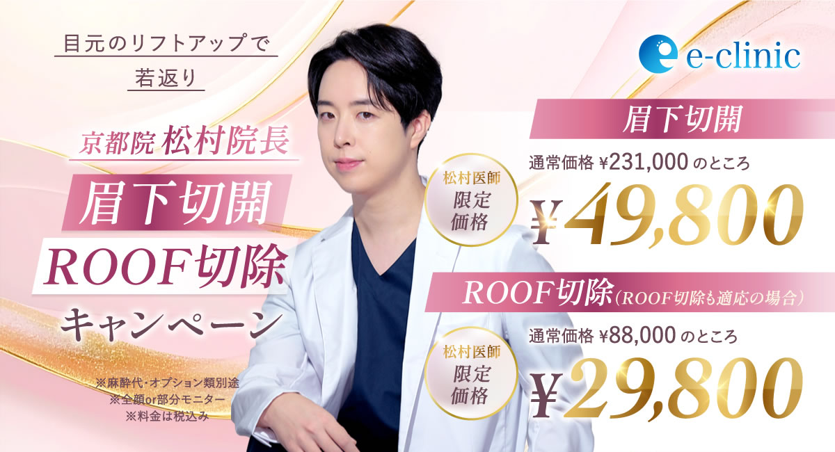 松村 健太医師の眉下切開のキャンペーンバナー