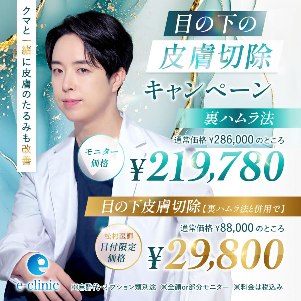 松村 健太医師の裏ハムラのキャンペーンバナー