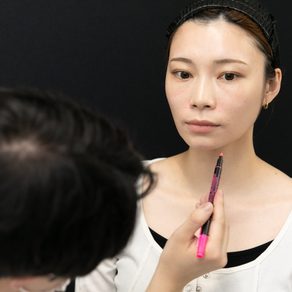 脂肪注入のデザインをしている医師