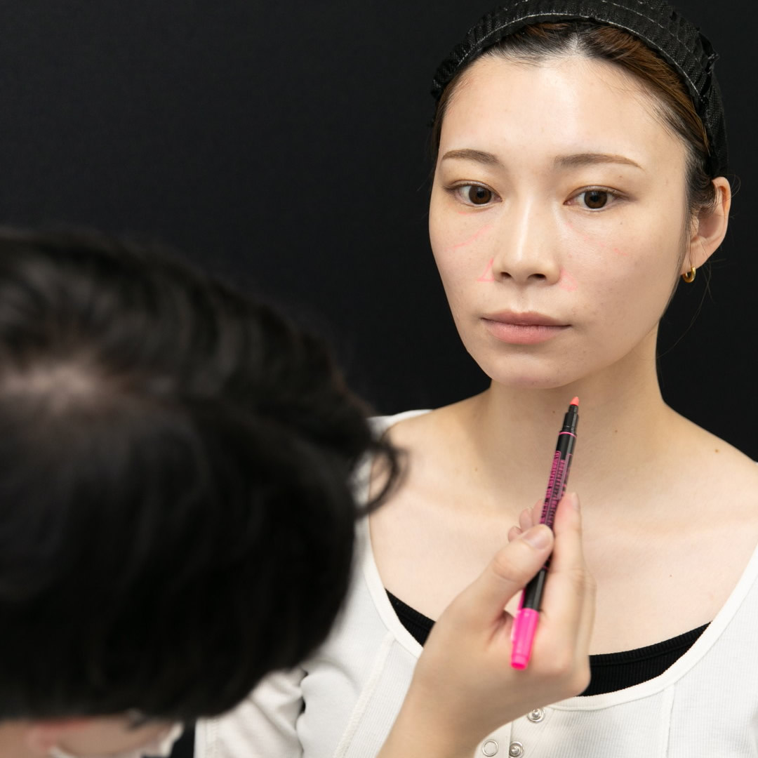 脂肪注入のデザインをしている医師