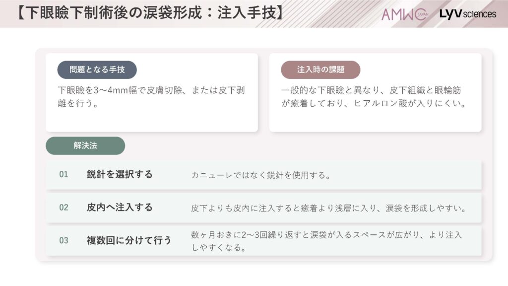 21_下眼瞼下制術後の涙袋形成:注入手技